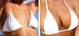 Крем-скульптор для грудей та сідниць “Perfect Curve”